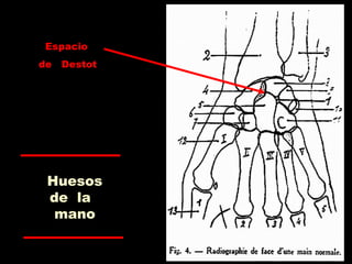 Huesos
de la
mano
Espacio
de Destot
 
