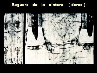 Reguero de la cintura ( dorso )
 