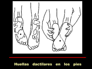 Huellas dactilares en los pies
 