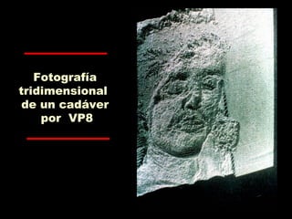 Fotografía
tridimensional
de un cadáver
por VP8
 