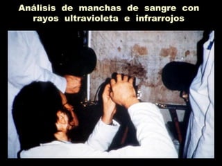Análisis de manchas de sangre con
rayos ultravioleta e infrarrojos
 