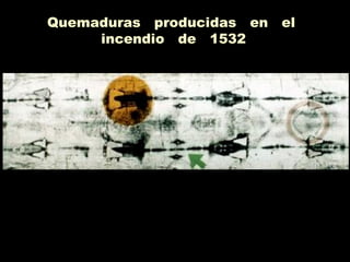 Quemaduras producidas en el
incendio de 1532
 