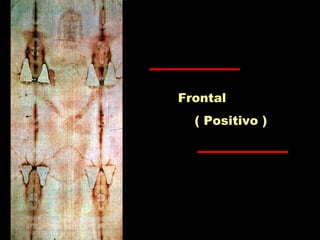 Frontal
( Positivo )
 