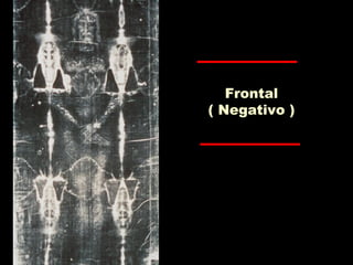 Frontal
( Negativo )
 
