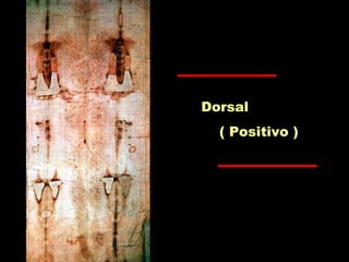 Dorsal
( Positivo )
 