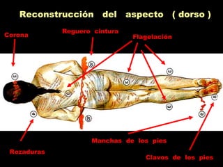 Reconstrucción del aspecto ( dorso )
Corona
Reguero cintura
Flagelación
Rozaduras
Manchas de los pies
Clavos de los pies
 