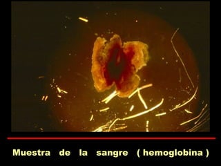 Muestra de la sangre ( hemoglobina )
 