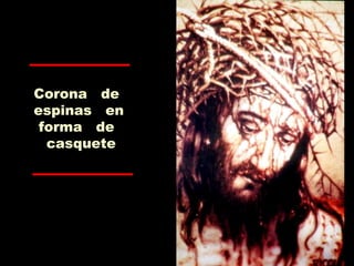 Corona de
espinas en
forma de
casquete
 
