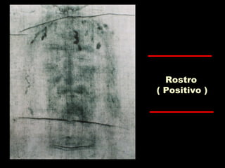 Rostro
( Positivo )
 