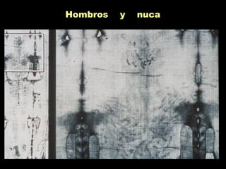 Hombros y nuca
 