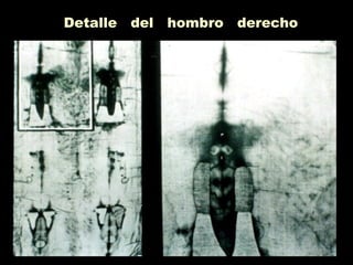 Detalle del hombro derecho
 