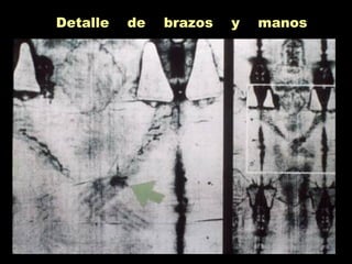 Detalle de brazos y manos
 