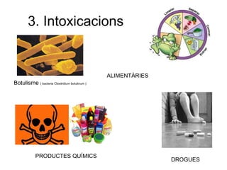3. Intoxicacions  Botulisme  ( bacteria Clostridium botulinum ) ALIMENTÀRIES PRODUCTES QUÍMICS DROGUES 