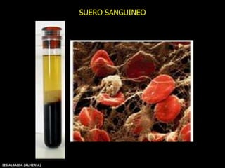 IES ALBAIDA (ALMERÍA)
SUERO SANGUINEO
 