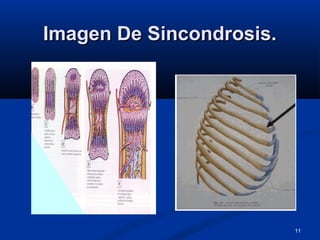 11
Imagen De Sincondrosis.Imagen De Sincondrosis.
 
