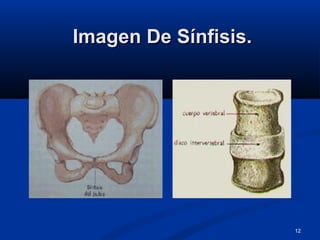 12
Imagen De Sínfisis.Imagen De Sínfisis.
 