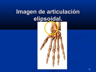 19
Imagen de articulaciónImagen de articulación
elipsoidal.elipsoidal.
 