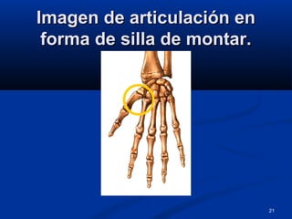 21
Imagen de articulación enImagen de articulación en
forma de silla de montar.forma de silla de montar.
 