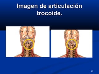 25
Imagen de articulaciónImagen de articulación
trocoide.trocoide.
 