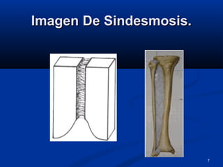 7
Imagen De Sindesmosis.Imagen De Sindesmosis.
 