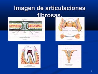 9
Imagen de articulacionesImagen de articulaciones
fibrosas.fibrosas.
 