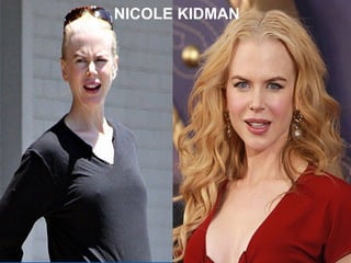 ANTES DEL MAQUILLAJE DESPUES DEL MAQUILLAJE NICOLE KIDMAN 