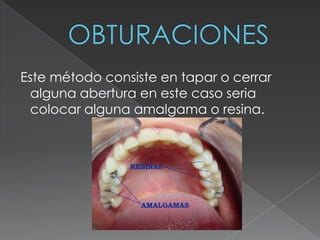 Este método consiste en tapar o cerrar
  alguna abertura en este caso seria
  colocar alguna amalgama o resina.
 