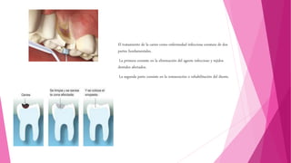 El tratamiento de la caries como enfermedad infecciosa constara de dos
partes fundamentales.
La primera consiste en la eliminación del agente infeccioso y tejidos
dentales afectados.
La segunda parte consiste en la restauración o rehabilitación del diente.
 