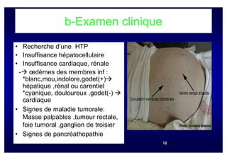 b-Examen clinique
• Recherche d’une HTP
• Insuffisance hépatocellulaire
• Insuffisance cardiaque, rénale
 - œdèmes des membres inf :
  *blanc,mou,indolore,godet(+)
  hépatique ,rénal ou carentiel
  *cyanique, douloureux ,godet(-)
  cardiaque
• Signes de maladie tumorale:
  Masse palpables ,tumeur rectale,
  foie tumoral ,ganglion de troisier
• Signes de pancréathopathie
                                       12
 
