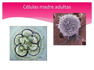 Células madre adultas
 