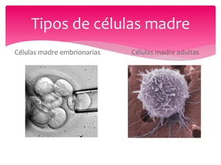 Tipos de células madre
Células madre embrionarias   Células madre adultas
 
