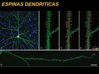 ESPINAS DENDRITICAS 
 