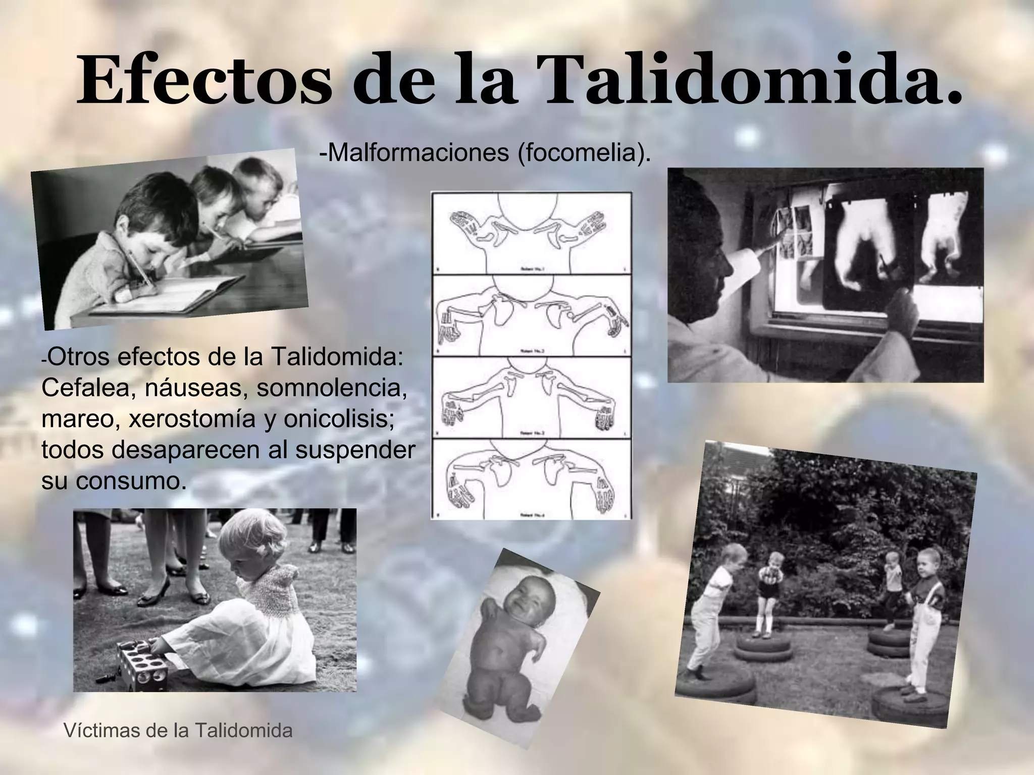 Las dos caras de la Talidomida.
