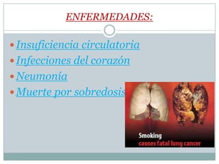 ENFERMEDADES:
Insuficiencia circulatoria
Infecciones del corazón
Neumonía
Muerte por sobredosis