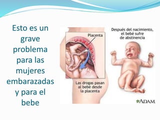 Esto es un
grave
problema
para las
mujeres
embarazadas
y para el
bebe
 