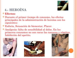4.- HEROÍNA
 Efectos:
 Durante el primer tiempo de consumo, los efectos
principales de la administración de heroína son los
siguientes:
 Euforia, Sensación de bienestar, Placer.
 Analgesia: falta de sensibilidad al dolor, En los
primeros consumos no son raras las nauseas y vómitos,
Inhibición del apetito.
 