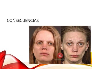 CONSECUENCIAS
 
