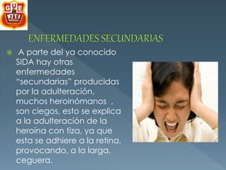  A parte del ya conocido 
SIDA hay otras 
enfermedades 
“secundarias” producidas 
por la adulteración, 
muchos heroinómanos , 
son ciegos, esto se explica 
a la adulteración de la 
heroína con tiza, ya que 
esta se adhiere a la retina, 
provocando, a la larga, 
ceguera. 
 