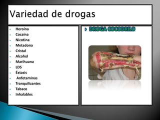 Heroína
Cocaína
Nicotina
Metadona
Cristal
Alcohol
Marihuana
LDS
Éxtasis
Anfetaminas
Tranquilizantes
Tabaco
Inhalables



DROGA COCODRILO

 