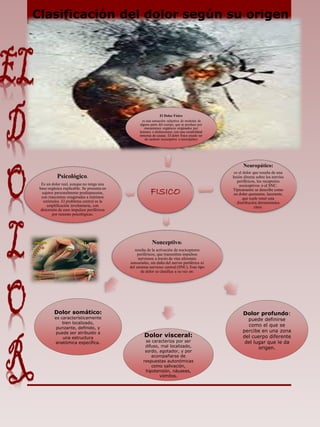 FISICO
El Dolor Físico
es una sensación subjetiva de molestia de
alguna parte del cuerpo, que se produce por
mecanismos orgánicos originados por
lesiones o disfunciones con una variabilidad
inmensa de causas. El dolor físico puede ser
de carácter nociceptivo o neuropático
Neuropático:
es el dolor que resulta de una
lesión directa sobre los nervios
periféricos, los receptores
nociceptivos o el SNC.
Típicamente se describe como
un dolor quemante, lacerante,
que suele tener una
distribución dermatómica
clara.
Nonceptivo:
resulta de la activación de nociceptores
periféricos, que transmiten impulsos
nerviosos a través de vías aferentes
sensoriales, sin daño del nervio periférico ni
del sistema nervioso central (SNC). Este tipo
de dolor se clasifica a su vez en:
Psicológico.
Es un dolor real, aunque no tenga una
base orgánica explicable. Se presenta en
sujetos personalmente predispuestos,
con reacciones exageradas a mínimos
estímulos. El problema central es la
amplificación involuntaria, con
distorsión de esos impulsos periféricos
por razones psicológicas.
Dolor somático:
es característicamente
bien localizado,
punzante, definido, y
puede ser atribuido a
una estructura
anatómica específica.
Dolor visceral:
se caracteriza por ser
difuso, mal localizado,
sordo, agotador, y por
acompañarse de
respuestas autonómicas
como salivación,
hipotensión, náuseas,
vómitos.
Dolor profundo:
puede definirse
como el que se
percibe en una zona
del cuerpo diferente
del lugar que le da
origen.
Clasificación del dolor según su origen
 