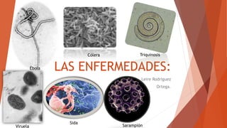LAS ENFERMEDADES:
Leire Rodriguez
Ortega.
Cólera
Ébola
Triquinosis
Sida
SarampiónViruela
 