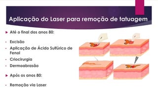 Aplicação do Laser para remoção de tatuagem
 Até o final dos anos 80:
• Excisão
• Aplicação de Ácido Sulfúrico de
Fenol
• Criocirurgia
• Dermoabrasão
 Após os anos 80:
• Remoção via Laser
 