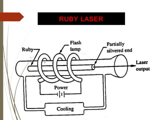 RUBY LASER 
 