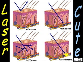 Laser Cute Riflessione Diffusione Trasmissione Assorbimento 