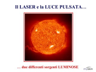 Il LASER e la LUCE PULSATA… …  due differenti sorgenti LUMINOSE 