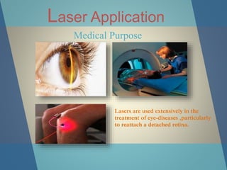 Laser Application
Medical Purpose
Lasers are used extensively in the
treatment of eye-diseases ,particularly
to reattach a detached retina.
 