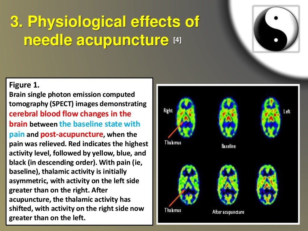 Laser acupuncture Practical guidelines