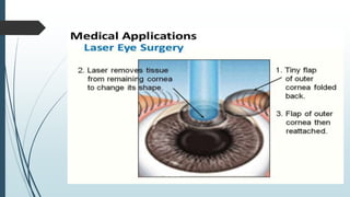 Laser and its application