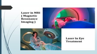 Laser and its application