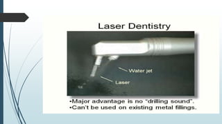 Laser and its application